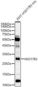 Western blot analysis of 293T-HSD17B3-His, using Anti-HSD17B3 Antibody (A10198) at 1:2,500 dilution. The secondary antibody was Goat Anti-Rabbit IgG H&L Antibody (HRP) at 1:10,000 dilution.