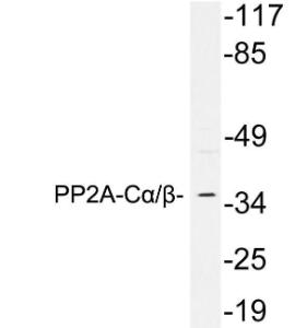 Anti-PP2A C alpha and beta antibody