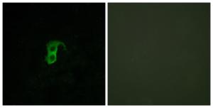 Immunofluorescence analysis of HUVEC cells using Anti-GPR87 Antibody The right hand panel represents a negative control, where the antibody was pre-incubated with the immunising peptide