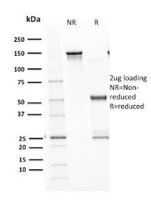 SDS-PAGE analysis of Anti-p53 Antibody [TP53/1799R] under non-reduced and reduced conditions; showing intact IgG and intact heavy and light chains, respectively. SDS-PAGE analysis confirms the integrity and purity of the antibody.