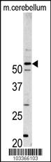 Anti-CDK14 Rabbit Polyclonal Antibody