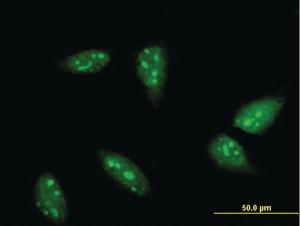 Anti-RNF6 Mouse Monoclonal Antibody [clone: 3B1]