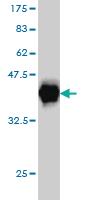 Anti-EWSR1 Mouse Monoclonal Antibody [clone: 5C10]