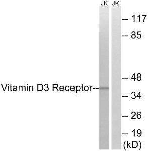 Antibody anti-VITAMIN D3 receptor 100 µg