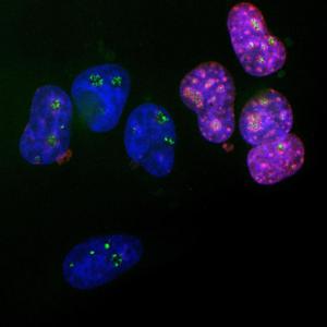 Immunofluorescent analysis of HeLa cells stained with Anti-Ki67 Antibody (1:5000/red), and Anti-Fibrillarin Antibody (1:2,000/green)