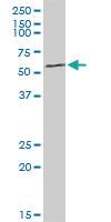 Anti-ARHGEF5 Rabbit Polyclonal Antibody