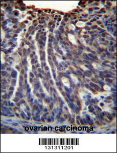 Anti-HOXB3 Rabbit Polyclonal Antibody (Biotin)