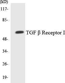 Western blot analysis of the lysates from HeLa cells using Anti-TGF beta Receptor I Antibody