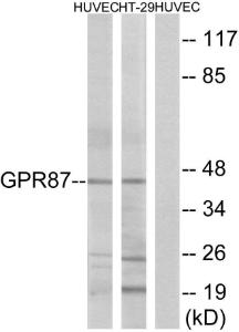 Western blot analysis of lysates from HUVEC and HT-29 cells using Anti-GPR87 Antibody The right hand lane represents a negative control, where the antibody is blocked by the immunising peptide