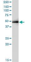 Anti-PDLIM7 Polyclonal Antibody Pair