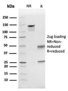 SDS-PAGE analysis of Anti-CD74 Antibody [CLIP/6609] under non-reduced and reduced conditions; showing intact IgG and intact heavy and light chains, respectively. SDS-PAGE analysis confirms the integrity and purity of the Antibody