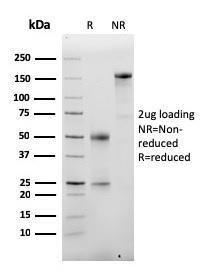 SDS-PAGE analysis of Anti-Albumin Antibody [ALB/2355] under non-reduced and reduced conditions; showing intact IgG and intact heavy and light chains, respectively. SDS-PAGE analysis confirms the integrity and purity of the antibody.