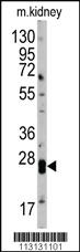 Anti-CLDN1 Rabbit Polyclonal Antibody