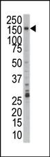 Anti-PRPF4B Rabbit Polyclonal Antibody