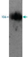 Anti-PML Rabbit Polyclonal Antibody