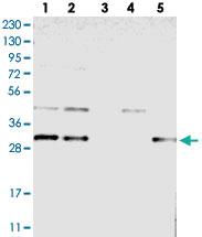 Anti-TMEM17 Rabbit Polyclonal Antibody