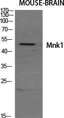 Antibody anti-MKNK1 100 µg