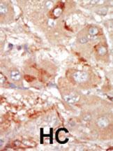 Anti-PRPF4B Rabbit Polyclonal Antibody