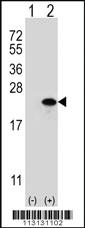 Anti-CLDN1 Rabbit Polyclonal Antibody