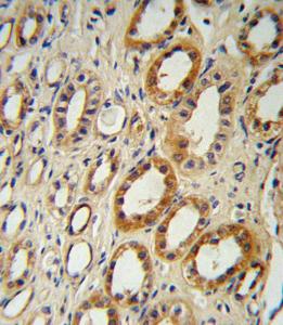 Anti-CYP27B1 Rabbit Polyclonal Antibody