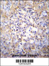 Anti-TSNARE1 Rabbit Polyclonal Antibody (HRP (Horseradish Peroxidase))