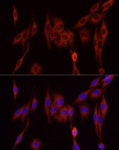 Anti-SFRP2 Rabbit Polyclonal Antibody