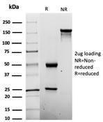 SDS-PAGE analysis of Anti-Penicillin Antibody [Pen-9] under non-reduced and reduced conditions; showing intact IgG and intact heavy and light chains, respectively. SDS-PAGE analysis confirms the integrity and purity of the Antibody