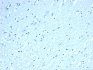 Negative Tissue Control: Immunohistochemical analysis of formalin-fixed, paraffin-embedded human brain using Anti-Inhibin alpha Antibody [INHA/6598R] at 2 µg/ml in PBS for 30  minutes at room temperature