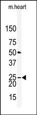 Anti-CLDN2 Rabbit Polyclonal Antibody