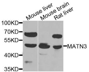 Western blot analysis of extracts of various cell lines, using Anti-MATN3 Antibody (A7700) at 1:1,000 dilution