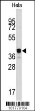 Anti-DNAJB1 Rabbit Polyclonal Antibody