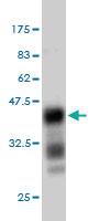 Anti-EXT1 Mouse Monoclonal Antibody [clone: 5A5]