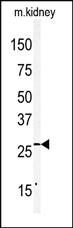 Anti-CLDN2 Rabbit Polyclonal Antibody