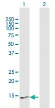 Anti-PRY2 Mouse Polyclonal Antibody