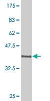 Anti-POU6F1 Mouse Monoclonal Antibody [clone: 6F10]