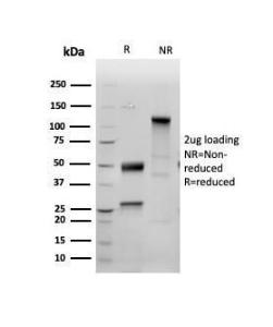 SDS-PAGE analysis of Anti-Inhibin alpha Antibody [INHA/6598R] under non-reduced and reduced conditions; showing intact IgG and intact heavy and light chains, respectively. SDS-PAGE analysis confirms the integrity and purity of the Antibody