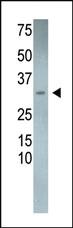 Anti-RCAN3 Rabbit Polyclonal Antibody