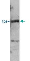 Anti-PML Rabbit Polyclonal Antibody