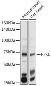 Western blot analysis of extracts of various cell lines, using Anti-PFKL Antibody (A10207) at 1:1,000 dilution