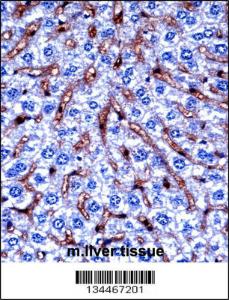 Anti-DYRK2 Rabbit Polyclonal Antibody (AP (Alkaline Phosphatase))