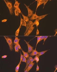 Immunofluorescence analysis of NIH/3T3 cells using Anti-PFKL Antibody (A10207) at a dilution of 1:100. DAPI was used to stain the cell nuclei (blue)