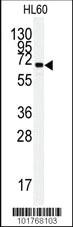 Anti-HSPA5 Rabbit Polyclonal Antibody