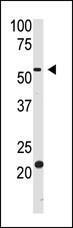 Anti-BACE2 Rabbit Polyclonal Antibody (AP (Alkaline Phosphatase))