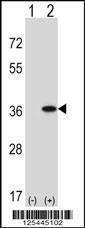 Anti-GNAQ Rabbit Polyclonal Antibody (PE (Phycoerythrin))