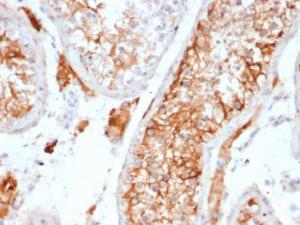 Immunohistochemical analysis of formalin-fixed, paraffin-embedded human testis tissue using Anti-Inhibin alpha Antibody [INHA/6598R]