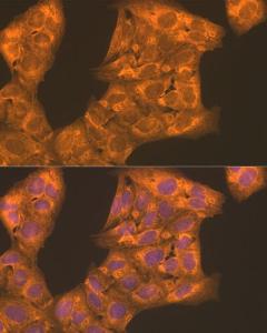 Immunofluorescence analysis of U2OS cells using Anti-PFKL Antibody (A10207) at a dilution of 1:100. DAPI was used to stain the cell nuclei (blue)