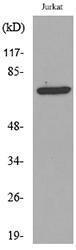 Anti-p73 Delta N Rabbit Polyclonal Antibody