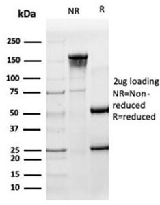 SDS-PAGE analysis of Anti-HA Tag Antibody [HA/279] under non-reduced and reduced conditions; showing intact IgG and intact heavy and light chains, respectively. SDS-PAGE analysis confirms the integrity and purity of the antibody