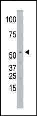 Anti-SPPL2A Rabbit Polyclonal Antibody