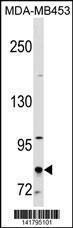 Anti-CTAGE1 Rabbit Polyclonal Antibody (PE (Phycoerythrin))